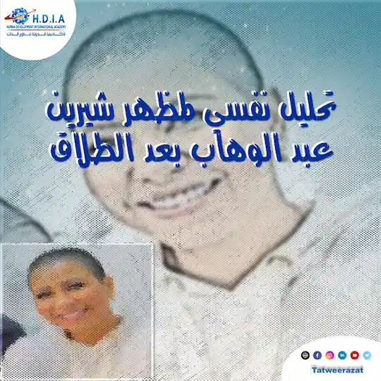 تحليل شخصية شيرين  بعد الطلاق - حلق زيرو